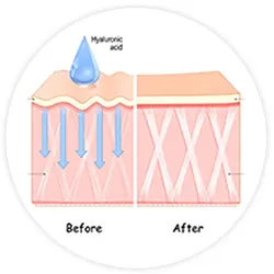 bio-dynamix-joint-genesis-hyaluronic-acid